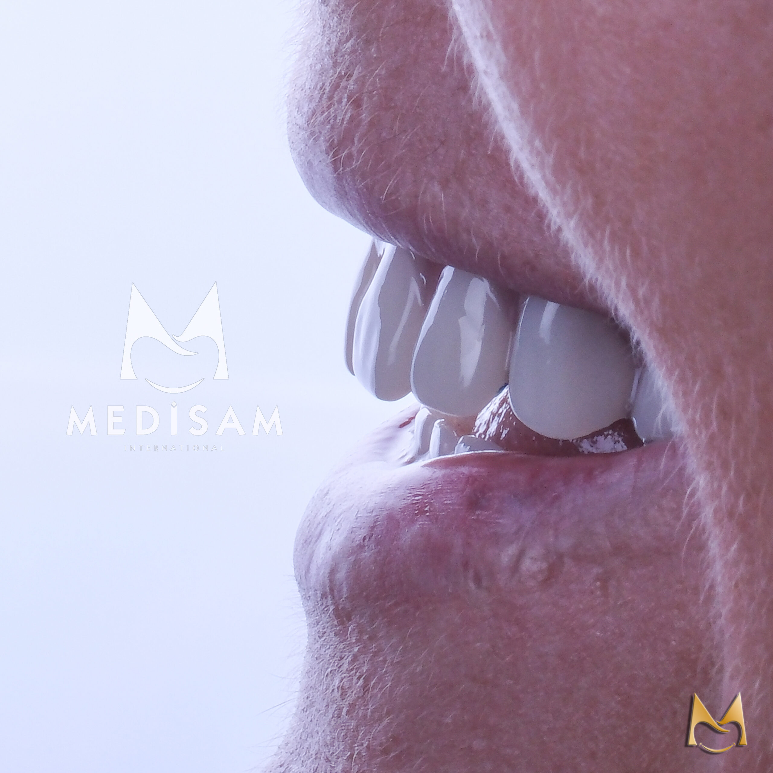 MEDİSAM KOLAJ kopya