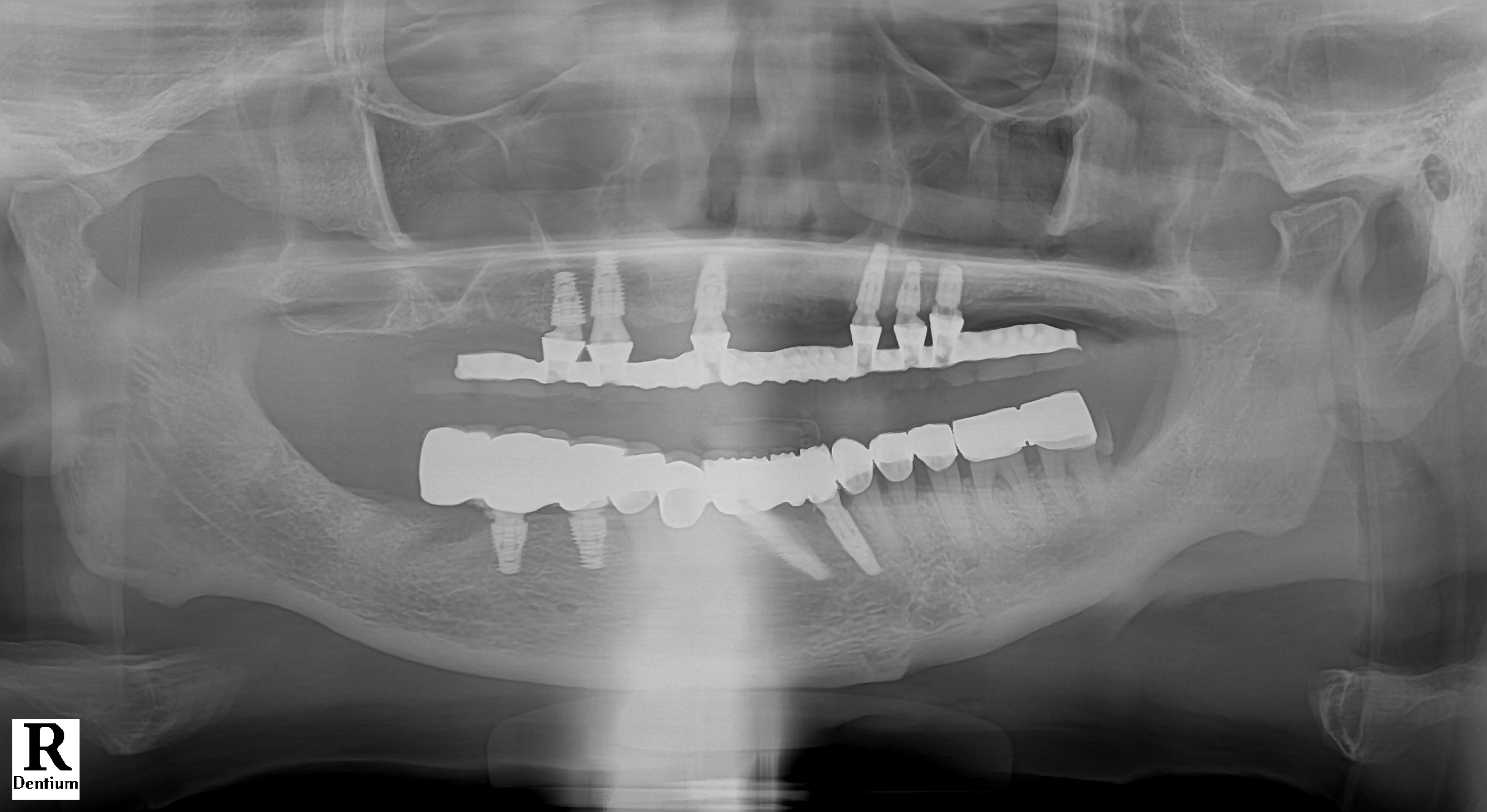 pa20240420_190200_0000